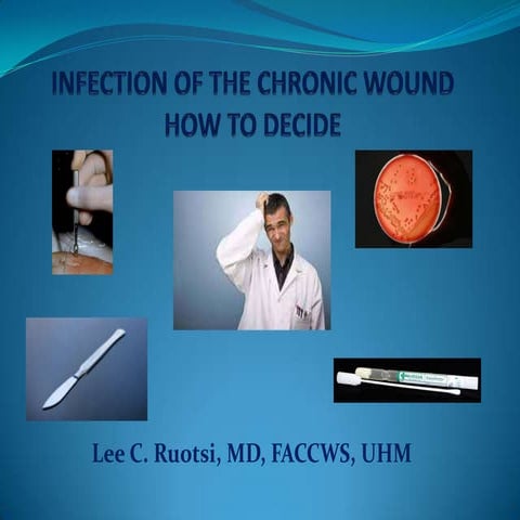 Infection of the chronic wound how to decide | PPTX