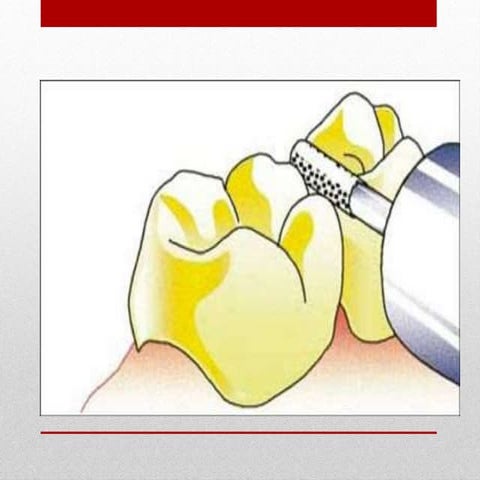 IT7F8YGU9IHJPO[.pptx