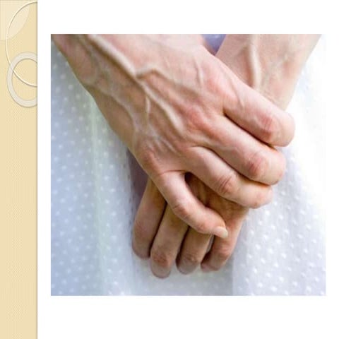 Intravenous cannulation