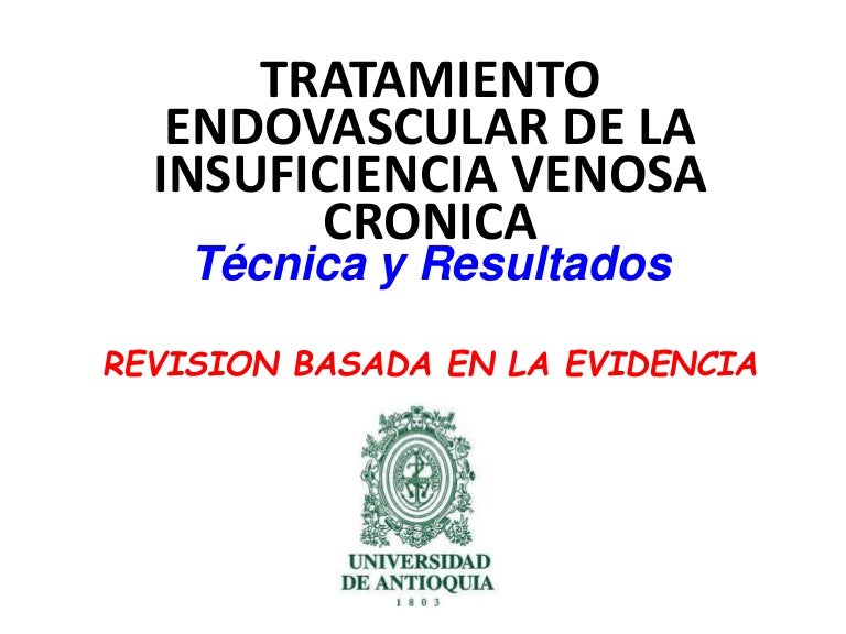 La la ablación vena de después pierna la de de ejercicio