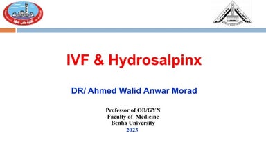 IVF and Hydrosalpinx 
