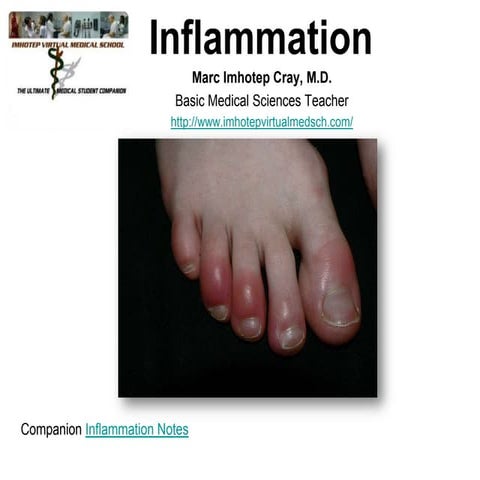 IVMS-Gen Path-Inflammation