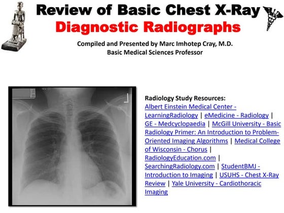 Medical Image Captioning of chest x-ray.pptx | Lung and Respiratory ...