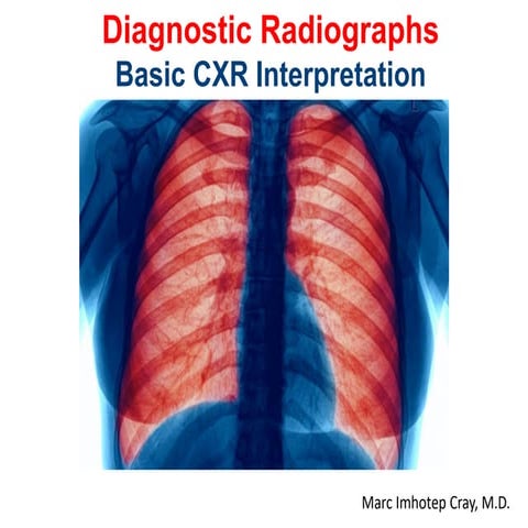 Basic CXR Interpretation_Diagnostic Radiographs
