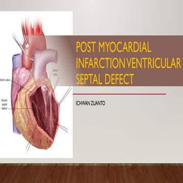 post myocardial infarction ventricular septal defect | PPTX