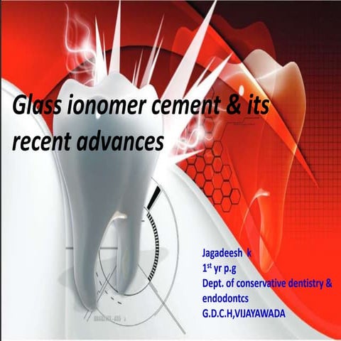 GLASS IONOMER CEMENT AND ITS RECENT ADVANCES- by Dr. JAGADEESH KODITYALA