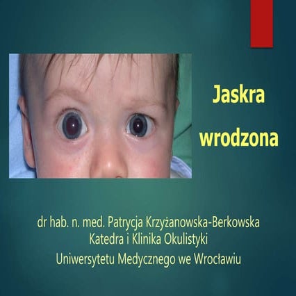 jaskra-wrodzona.ppt