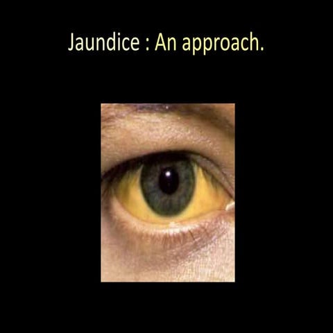 Jaundice