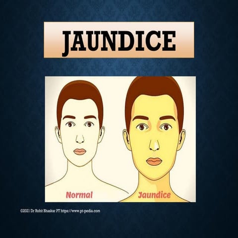 Jaundice - Dr Rohit Bhaskar