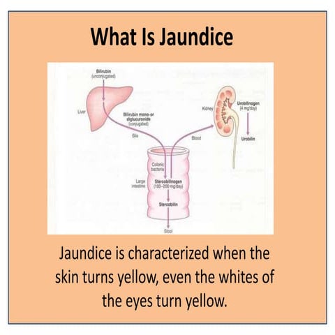 Jaundice10