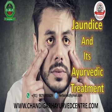 Jaundice and ayurvedic treatment