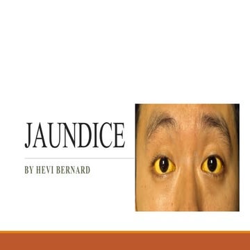 JAUNDICE HEVI  Jaundice basic for internal medicine and some classification .pdf