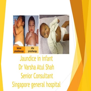 Jaundice in infant