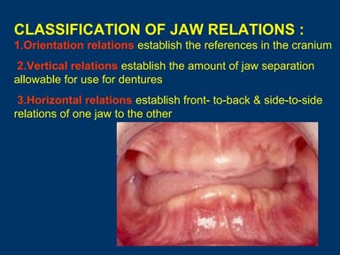 Jaw relation