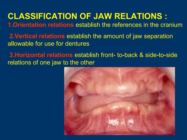 Jaw relation