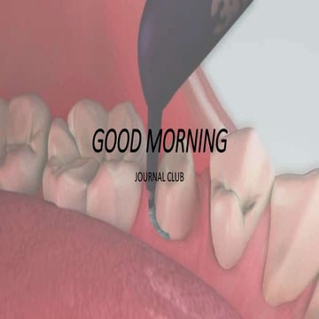 gingival retraction methods