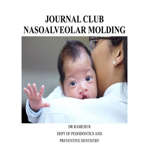 nasoalveolar molding