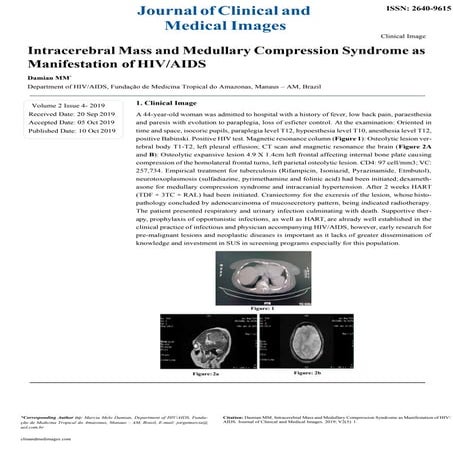 Odontogenic Maxillary Sinusitis – Report of a Case | PDF