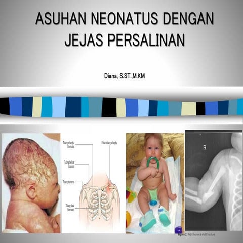 Asuhan Jejas Persalinan pada bayi dan neonatus | PDF