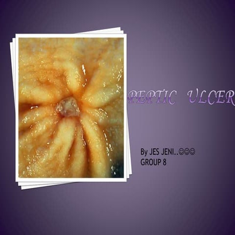 PEPTIC ULCER