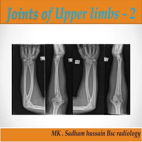 Joints of upper limbs 