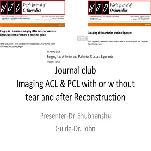 Journal club ACL PCL.pptx