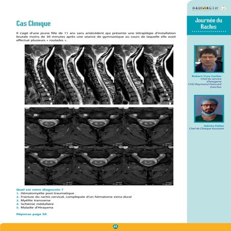 Journée du rachis : cas clinique | PDF