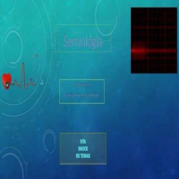 Juliana garcia hta shock