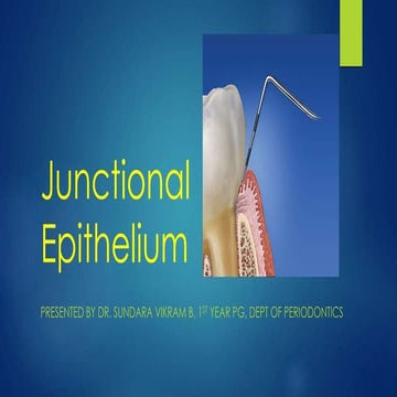 Junctional epithelium