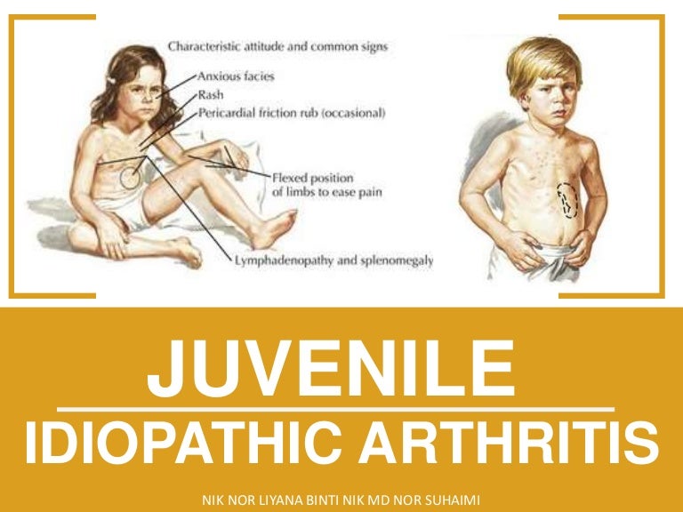 Juvenile idiopathic arthritis (JIA)