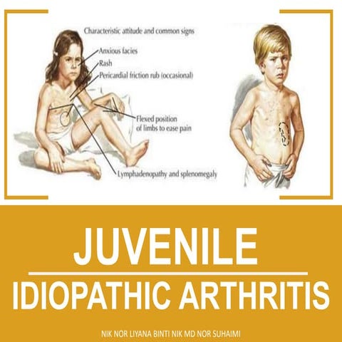 Juvenile idiopathic arthritis (JIA) | PPT