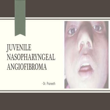 Juvenile nasopharyngeal angiofibroma