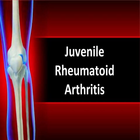 Juvenile+Rheumatoid+Arthritis+slides+