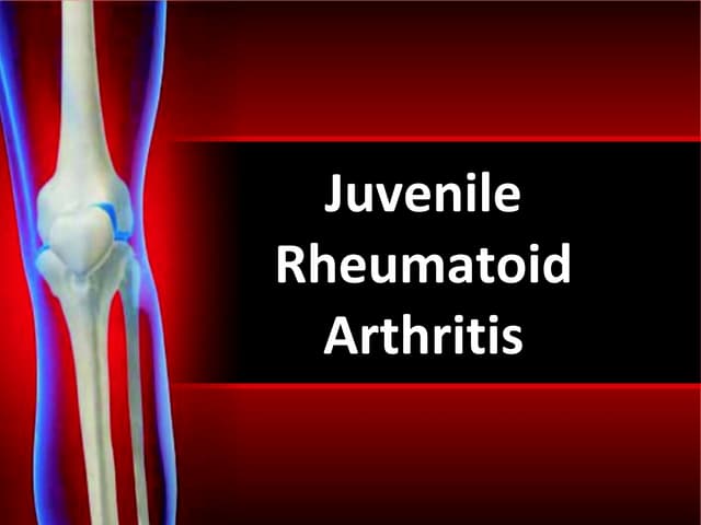 Juvenile rheumatoid arthritis | PPT