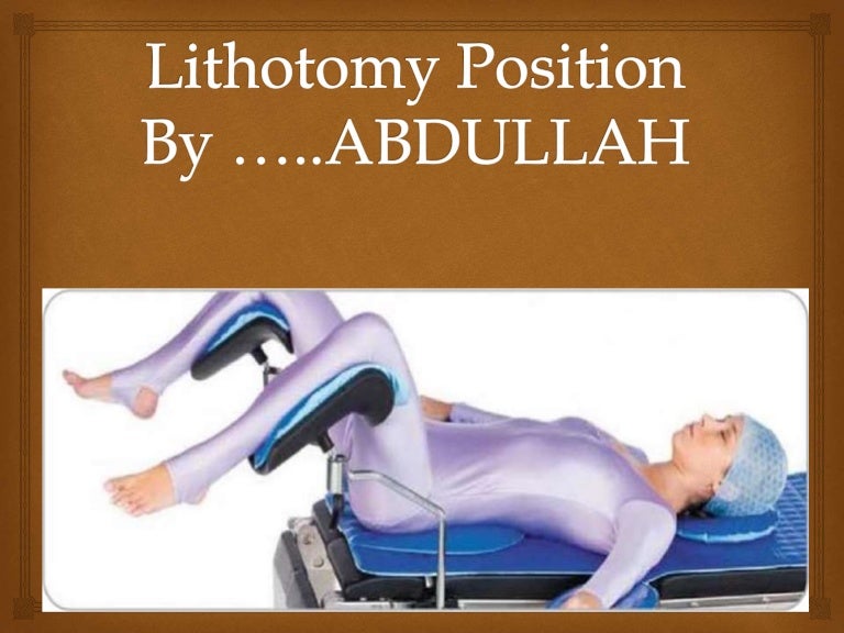 Lithotomy position abdullah