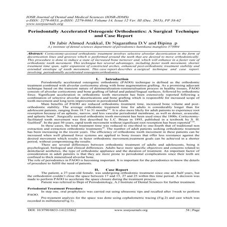 Periodontally Accelerated Osteogenic Orthodontics: A Surgical Technique ...
