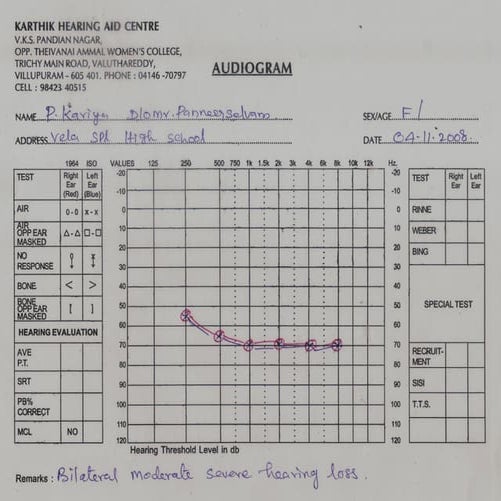 Audiogram 7 children | PDF