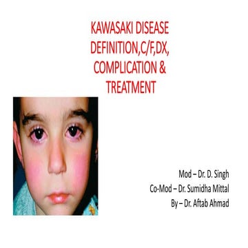 Kawasaki disease