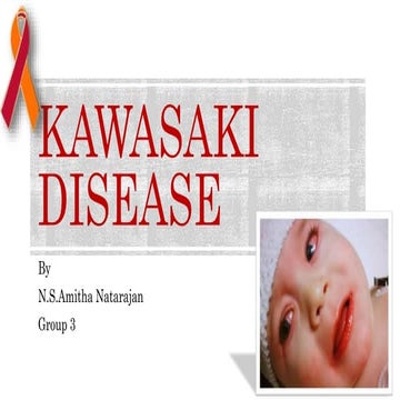Kawasaki disease