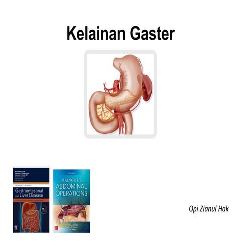 Kelainan Gaster diagnosis komplikasi dan tatalakasana | PPTX