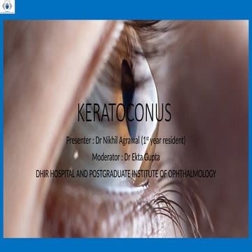 KERATOCONUS.pptx case presentation and discussion