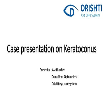 A case presentation on Keratoconus - by Ashi