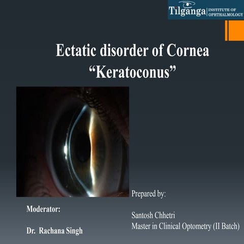 Keratoconus   and Its management