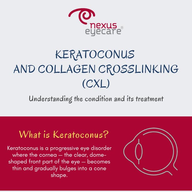 Keratoconus and Collagen Crosslinking (CXL)