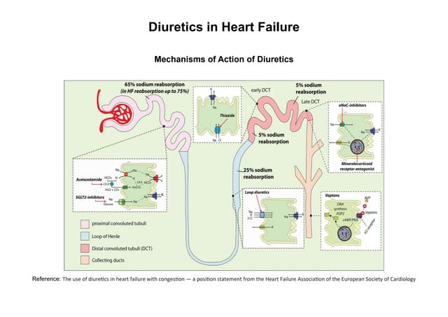 When To Stop Diuretics In Heart Failure