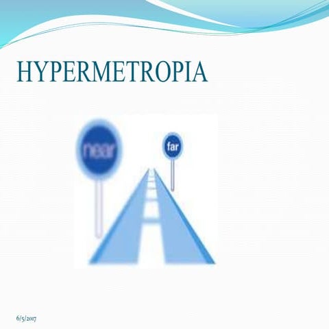 Hypermetropia also known as Hyperopia or Farsightedness is a common type of r...