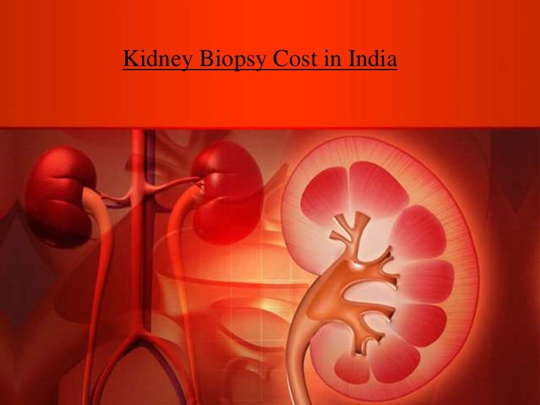 kidney-biopsy-in-delhi
