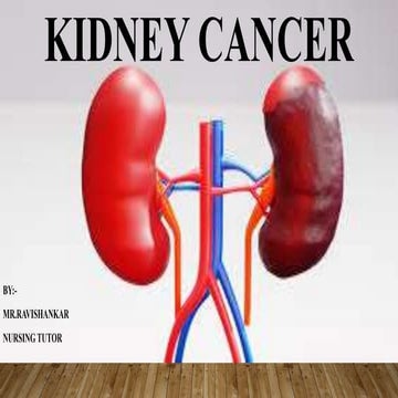 KIDNEY CANCER.pptx