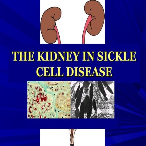 Kidney in sickle cell disease