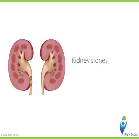 Kidney stones v0.4ppt